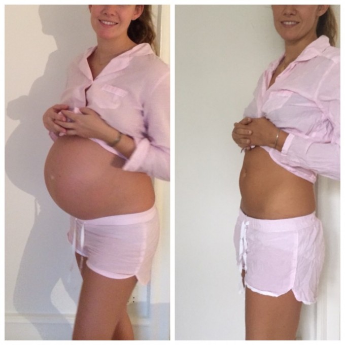 før og efter graviditet nr 2