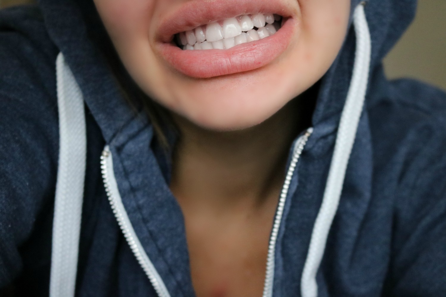 Sådan får jeg hvide tænder! | Fie Laursen