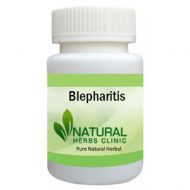 Herbal Products for Blepharitis