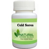 Herbal Products for Cold Sores