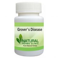 Herbal Products for Grover's Disease