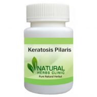 Herbal Products for Keratosis Pilaris