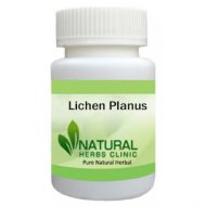 Herbal Products for Lichen Planus