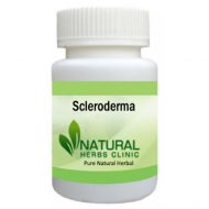 Herbal Products for Scleroderma