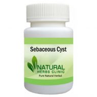Herbal Products for Sebaceous Cyst
