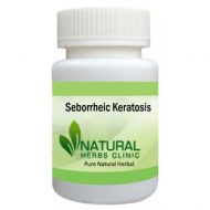 Herbal Products for Seborrheic Keratosis