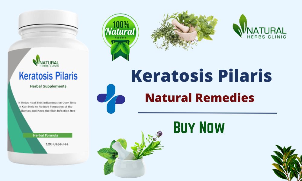 natural remedies for keratosis pilaris