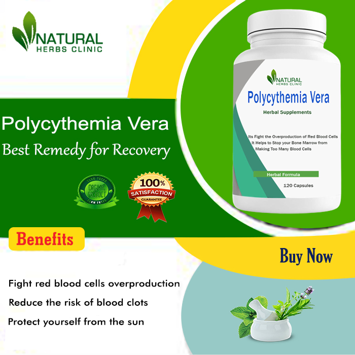 Home Remedies for Polycythemia Vera