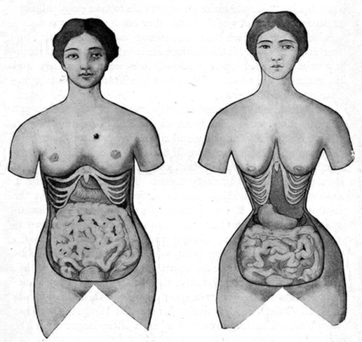 corset-training-before-and-after
