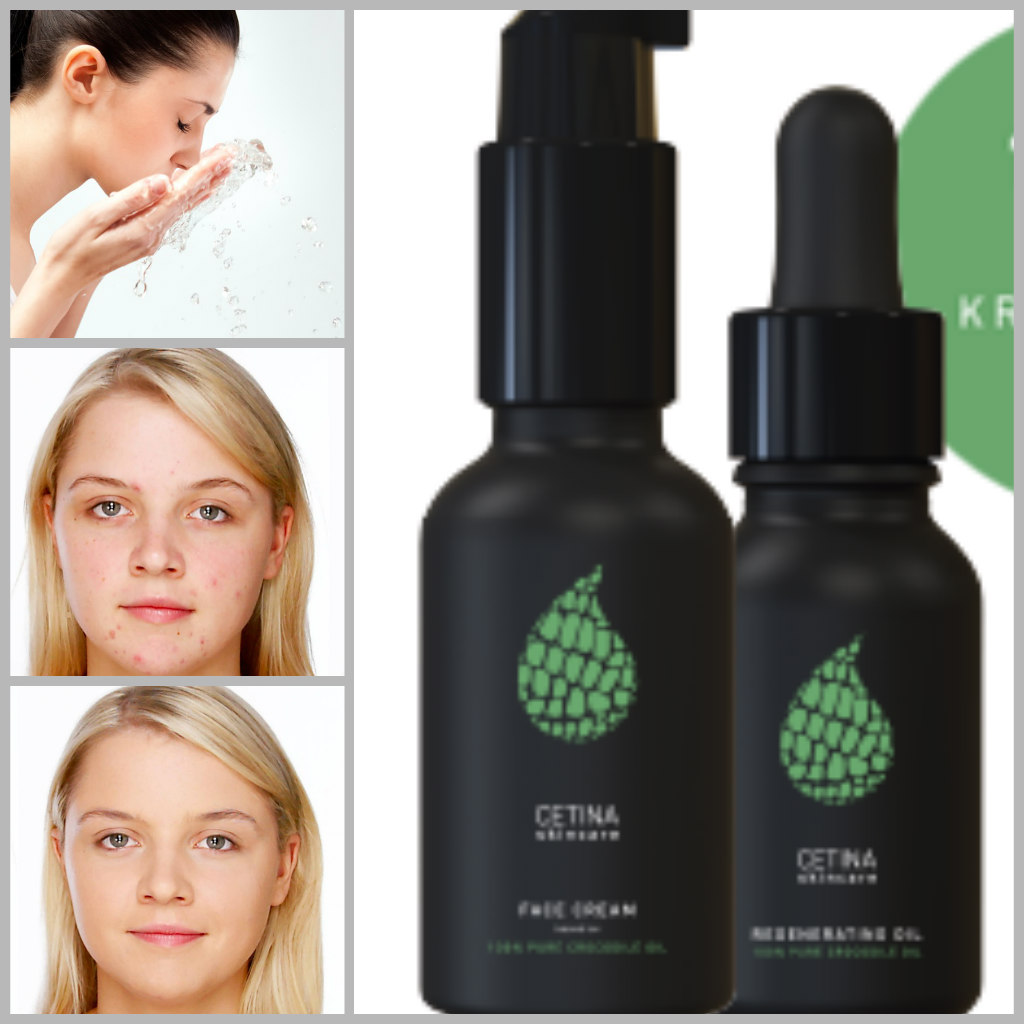 Sådan får jeg ren hud! How do I clean skin! | Beauty & Care