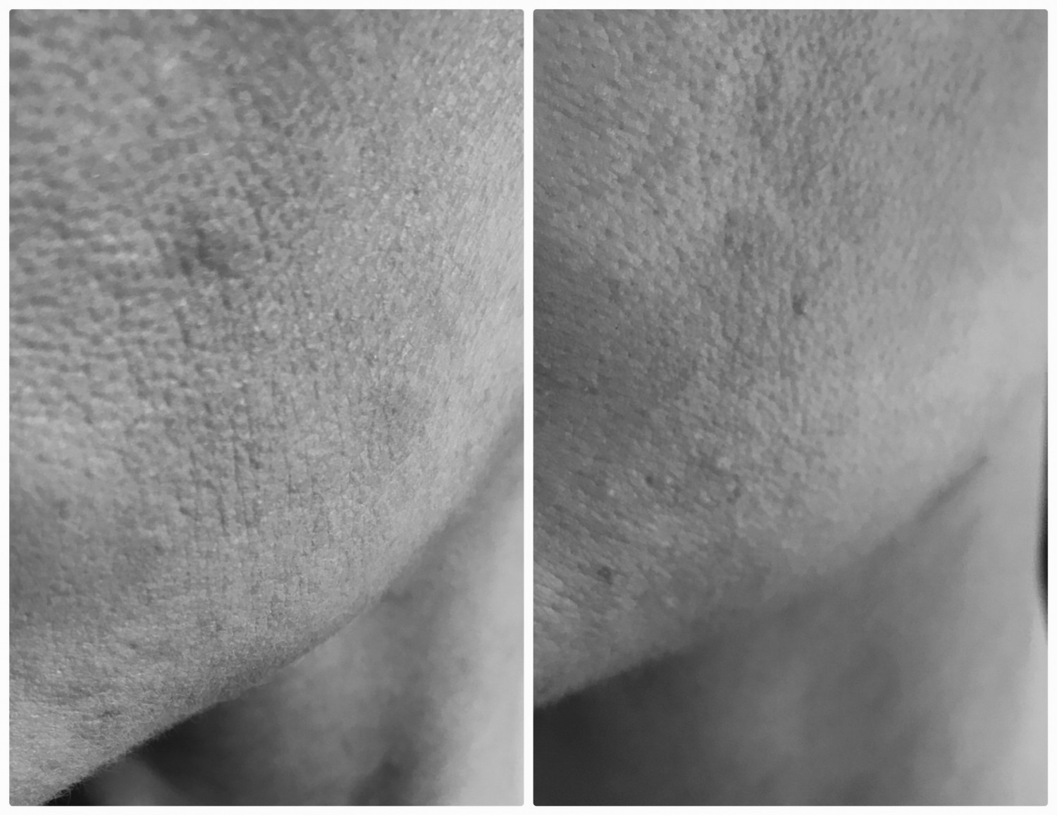 Test: The Soultion – Anti Wrinkle Collagen fra Oslo Skin Lab (se før/efter  billeder!) | Daglig Blog | Mascha Vang