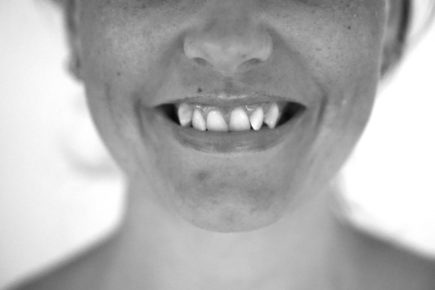 Et sæt nye tænder | Personlig | Camilla Julie